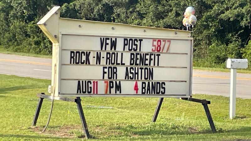 Community comes together for benefit concert for 13-year-old shot in Aiken