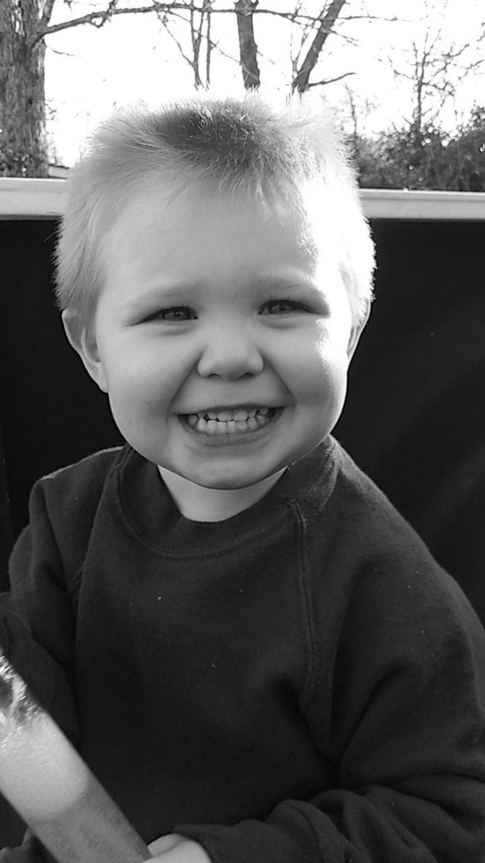 Child overdoses on Benadryl