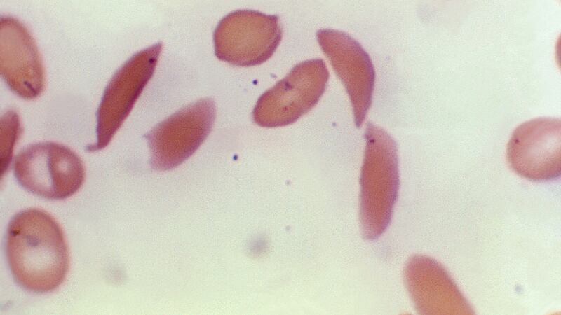 FILE - This microscope photo provided on Oct. 25, 2023, by the Centers for Disease Control and...
