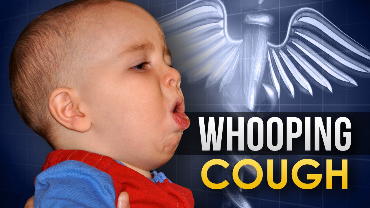 Whooping cough spreading in Buncombe County, officials say - Vimarsana News